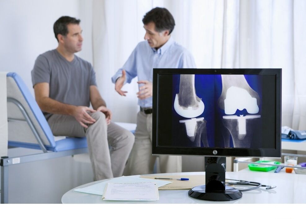 Артроза на колянната става в снимката на X -Ray